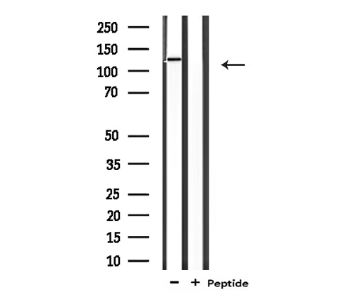 CARD6 Antibody - Western blot analysis of extracts of 293 cells using CARD6 antibody.