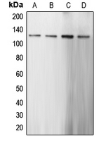 CARD6 Antibody - Western blot analysis of CARD6 expression in HeLa (A); Jurkat (B); mouse kidney (C); rat brain (D) whole cell lysates.