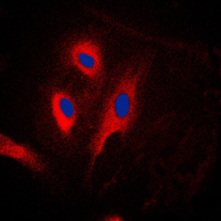 CARD6 Antibody - Immunofluorescent analysis of CARD6 staining in Jurkat cells. Formalin-fixed cells were permeabilized with 0.1% Triton X-100 in TBS for 5-10 minutes and blocked with 3% BSA-PBS for 30 minutes at room temperature. Cells were probed with the primary antibody in 3% BSA-PBS and incubated overnight at 4 C in a humidified chamber. Cells were washed with PBST and incubated with a DyLight 594-conjugated secondary antibody (red) in PBS at room temperature in the dark. DAPI was used to stain the cell nuclei (blue).