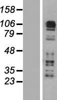 CARD6 Protein - Western validation with an anti-DDK antibody * L: Control HEK293 lysate R: Over-expression lysate
