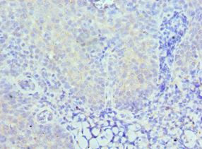 CARD8 / Cardinal / TUCAN Antibody - Immunohistochemistry of paraffin-embedded human tonsil using antibody at 1:100 dilution.