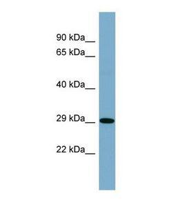 CARD8 / Cardinal / TUCAN Antibody - Western blot of Human Fetal spleen. CARD8 antibody dilution 1.0 ug/ml.  This image was taken for the unconjugated form of this product. Other forms have not been tested.