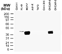 CARD8 / Cardinal / TUCAN Antibody - Western blot of TUCAN/CARD8 in tumor cell lines using Polyclonal Antibody to TUCAN/CARD8 at 1:2000. Cell lysates were normalized for total protein content.