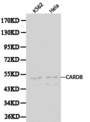 CARD8 / Cardinal / TUCAN Antibody - Western blot of CARD8 pAb in extracts from K562 and Hela cells.