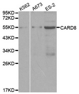 CARD8 / Cardinal / TUCAN Antibody - Western blot analysis of extracts of various cell lines, using CARD8 antibody at 1:1000 dilution. The secondary antibody used was an HRP Goat Anti-Rabbit IgG (H+L) at 1:10000 dilution. Lysates were loaded 25ug per lane and 3% nonfat dry milk in TBST was used for blocking.