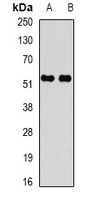 CARD8 / Cardinal / TUCAN Antibody - Western blot analysis of CARD 8 expression in K562 (A); ES2 (B) whole cell lysates.