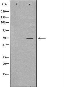 CARD8 / Cardinal / TUCAN Antibody - Western blot analysis of K562 whole cells lysates using CARD8 antibody. The lane on the left is treated with the antigen-specific peptide.