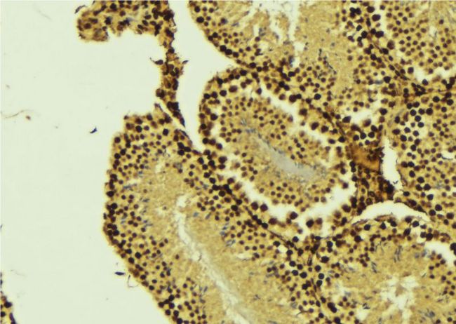 CARD8 / Cardinal / TUCAN Antibody - 1:100 staining mouse testis tissue by IHC-P. The sample was formaldehyde fixed and a heat mediated antigen retrieval step in citrate buffer was performed. The sample was then blocked and incubated with the antibody for 1.5 hours at 22°C. An HRP conjugated goat anti-rabbit antibody was used as the secondary.