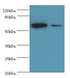 CARD9 Antibody - Western blot. All lanes: CARD9 antibody at 15 ug/ml. Lane 1: THP-1 whole cell lysate. Lane 2: Jurkat whole cell lysate. Secondary antibody: Goat polyclonal to rabbit at 1:10000 dilution. Predicted band size: 62 kDa. Observed band size: 62 kDa.