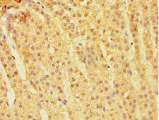 CARD9 Antibody - Immunohistochemistry of paraffin-embedded human adrenal gland using antibody at 1:100 dilution.