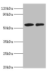CARD9 Antibody - Western blot All lanes: CARD9 antibody at 15µg/ml Lane 1: THP-1 whole cell lysate Lane 2: Jurkat whole cell lysate Secondary Goat polyclonal to rabbit IgG at 1/10000 dilution Predicted band size: 63, 57, 43 kDa Observed band size: 63 kDa