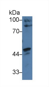 CARD9 Antibody - Western Blot; Sample: Human HepG2 cell lysate; Primary Ab: 3µg/ml Rabbit Anti-Human CARD9 Antibody Second Ab: 0.2µg/mL HRP-Linked Caprine Anti-Rabbit IgG Polyclonal Antibody