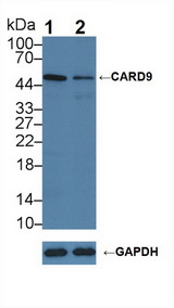 CARD9 Antibody - Knockout Varification: Lane 1: Wild-type PC3 cell lysate; Lane 2: CARD9 knockout PC3 cell lysate; Predicted MW: 62,56,43kd Observed MW: 50kd Primary Ab: 3µg/ml Rabbit Anti-Human CARD9 Antibody Second Ab: 0.2µg/mL HRP-Linked Caprine Anti-Rabbit IgG Polyclonal Antibody