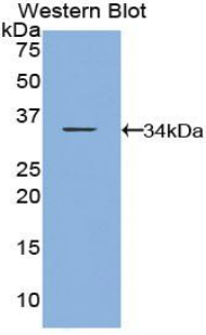 CARD9 Antibody - Western blot of recombinant CARD9.  This image was taken for the unconjugated form of this product. Other forms have not been tested.
