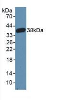 CARD9 Antibody - Western Blot; Sample: Recombinant CARD9, Mouse.