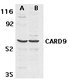 CARD9 Antibody - Western blot analysis of CARD9 expression in human MDA- MB-361 (A) and PC-3 (B) cell lysate withCARD9 antibody at 2.;