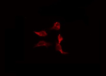 CARD9 Antibody - Staining HeLa cells by IF/ICC. The samples were fixed with PFA and permeabilized in 0.1% Triton X-100, then blocked in 10% serum for 45 min at 25°C. The primary antibody was diluted at 1:200 and incubated with the sample for 1 hour at 37°C. An Alexa Fluor 594 conjugated goat anti-rabbit IgG (H+L) Ab, diluted at 1/600, was used as the secondary antibody.