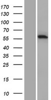CARD9 Protein - Western validation with an anti-DDK antibody * L: Control HEK293 lysate R: Over-expression lysate