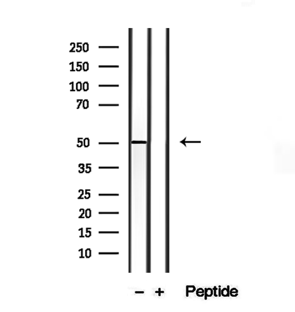 Cardiolipin Synthase / CRLS1 Antibody - Western blot analysis of extracts of mouse heart tissue using CRLS1-Specific antibody.