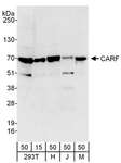 CARF / ALS2CR8 Antibody - Detection of Human and Mouse CARF by Western Blot. Samples: Whole cell lysate from 293T (15 and 50 ug), HeLa (H; 50 ug), Jurkat (J; 50 ug), and NIH3T3 (M; 50 ug) cells. Antibodies: Affinity purified rabbit anti-CARF antibody used for WB at 0.4 ug/ml. Detection: Chemiluminescence with an exposure time of 30 seconds.