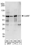 CARF / ALS2CR8 Antibody - Detection of Human CARF by Western Blot. Samples: Whole cell lysate from 293T (15 and 50 ug), HeLa (H; 50 ug), and Jurkat (J; 50 ug) cells. Antibodies: Affinity purified rabbit anti-CARF antibody used for WB at 0.4 ug/ml. Detection: Chemiluminescence with an exposure time of 30 seconds.
