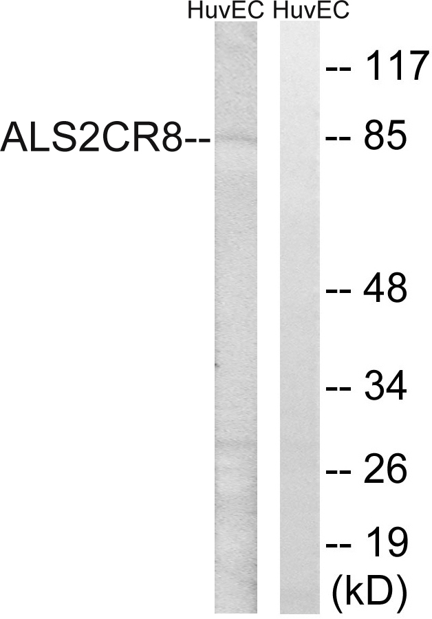 CARF / ALS2CR8 Antibody - Western blot analysis of lysates from HUVEC cells, using ALS2CR8 Antibody. The lane on the right is blocked with the synthesized peptide.