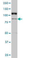CARF / ALS2CR8 Antibody - ALS2CR8 monoclonal antibody (M01), clone 2A3 Western blot of ALS2CR8 expression in HeLa NE.