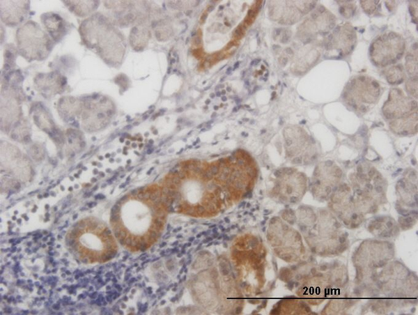 CARF / ALS2CR8 Antibody - Immunoperoxidase of monoclonal antibody to ALS2CR8 on formalin-fixed paraffin-embedded human salivary gland. [antibody concentration 1 ug/ml]