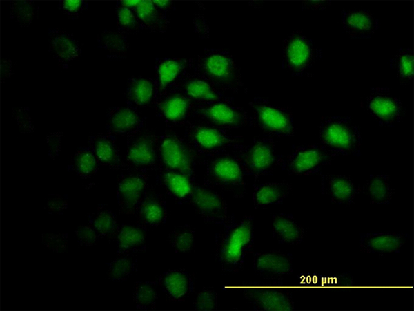 CARF / ALS2CR8 Antibody - Immunofluorescence of monoclonal antibody to ALS2CR8 on HeLa cell. [antibody concentration 10 ug/ml]