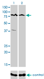 CARF / ALS2CR8 Antibody - Western blot of ALS2CR8 over-expressed 293 cell line, cotransfected with ALS2CR8 Validated Chimera RNAi (Lane 2) or non-transfected control (Lane 1). Blot probed with ALS2CR8 monoclonal antibody, clone 2A3. GAPDH ( 36.1 kD ) used as specificity and loading control.