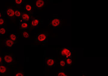 CARF / ALS2CR8 Antibody - Staining HuvEc cells by IF/ICC. The samples were fixed with PFA and permeabilized in 0.1% Triton X-100, then blocked in 10% serum for 45 min at 25°C. The primary antibody was diluted at 1:200 and incubated with the sample for 1 hour at 37°C. An Alexa Fluor 594 conjugated goat anti-rabbit IgG (H+L) Ab, diluted at 1/600, was used as the secondary antibody.
