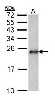 CARHSP1 Antibody - Sample (30 ug of whole cell lysate). A: Hep G2 . 15% SDS PAGE. CARHSP1 antibody diluted at 1:1000.