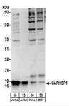 CARHSP1 Antibody - Detection of Human CARHSP1 by Western Blot. Samples: Whole cell lysate from Jurkat (15 and 50 ug), HeLa (50 ug), and 293T (50 ug) cells. Antibodies: Affinity purified rabbit anti-CARHSP1 antibody used for WB at 0.4 ug/ml. Detection: Chemiluminescence with an exposure time of 30 seconds.