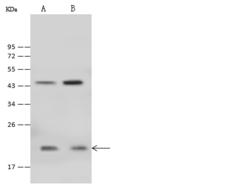 CARHSP1 Antibody - Anti-CARHSP1 rabbit polyclonal antibody at 1:500 dilution. Lane A: HepG2 Whole Cell Lysate. Lane B: HeLa Whole Cell Lysate. Lysates/proteins at 30 ug per lane. Secondary: Goat Anti-Rabbit IgG (H+L)/HRP at 1/10000 dilution. Developed using the ECL technique. Performed under reducing conditions. Predicted band size: 16 kDa. Observed band size: 21 kDa.