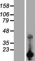 CARHSP1 Protein - Western validation with an anti-DDK antibody * L: Control HEK293 lysate R: Over-expression lysate