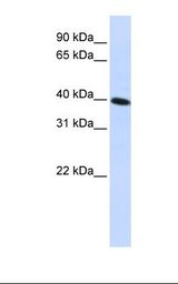CARKD Antibody - HepG2 cell lysate. Antibody concentration: 1.0 ug/ml. Gel concentration: 12%.  This image was taken for the unconjugated form of this product. Other forms have not been tested.
