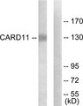 CARMA1 / CARD11 Antibody - Western blot analysis of lysates from COLO205 cells, using CARD11 Antibody. The lane on the right is blocked with the synthesized peptide.