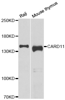 CARMA1 / CARD11 Antibody - Western blot analysis of extracts of various cell lines.