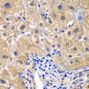CARMA1 / CARD11 Antibody - Immunohistochemistry of paraffin-embedded human liver injury tissue.