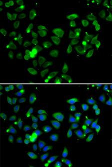 CARMA1 / CARD11 Antibody - Immunofluorescence analysis of A549 cells.