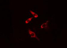 CARMA1 / CARD11 Antibody - Staining COLO205 cells by IF/ICC. The samples were fixed with PFA and permeabilized in 0.1% Triton X-100, then blocked in 10% serum for 45 min at 25°C. The primary antibody was diluted at 1:200 and incubated with the sample for 1 hour at 37°C. An Alexa Fluor 594 conjugated goat anti-rabbit IgG (H+L) antibody, diluted at 1/600, was used as secondary antibody.
