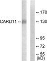 CARMA1 / CARD11 Antibody - Western blot analysis of extracts from COLO205 cells, using CARD11 antibody.