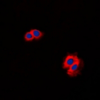 CARMA1 / CARD11 Antibody - Immunofluorescent analysis of CARD11 staining in K562 cells. Formalin-fixed cells were permeabilized with 0.1% Triton X-100 in TBS for 5-10 minutes and blocked with 3% BSA-PBS for 30 minutes at room temperature. Cells were probed with the primary antibody in 3% BSA-PBS and incubated overnight at 4 deg C in a humidified chamber. Cells were washed with PBST and incubated with a DyLight 594-conjugated secondary antibody (red) in PBS at room temperature in the dark. DAPI was used to stain the cell nuclei (blue).
