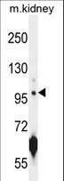 CARNS1 Antibody - ATPGD1 Antibody western blot of mouse kidney tissue lysates (35 ug/lane). The ATPGD1 antibody detected the ATPGD1 protein (arrow).