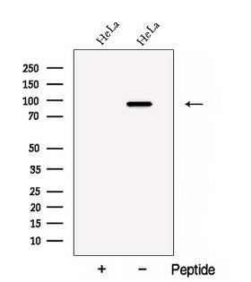 CARNS1 Antibody - Western blot analysis of extracts of HeLa cells using CARNS1 antibody. The lane on the left was treated with blocking peptide.
