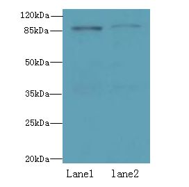 Carom / FCHSD2 Antibody - Western blot. All lanes: FCHSD2 antibody at 12 ug/ml. Lane 1: U251 whole cell lysate. Lane 2: A549 whole cell lysate. Secondary Goat polyclonal to Rabbit IgG at 1:10000 dilution. Predicted band size: 84 kDa. Observed band size: 84 kDa.