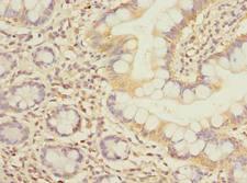 Carom / FCHSD2 Antibody - Immunohistochemistry of paraffin-embedded human small intestine tissue using antibody at dilution of 1:100.