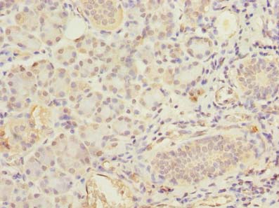 Carom / FCHSD2 Antibody - Immunohistochemistry of paraffin-embedded human pancreatic tissue using antibody at dilution of 1:100.