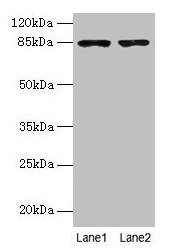 Carom / FCHSD2 Antibody - Western blot All lanes: FCHSD2 antibody at 12µg/ml Lane 1: U251 whole cell lysate Lane 2: A549 whole cell lysate Secondary Goat polyclonal to rabbit IgG at 1/10000 dilution Predicted band size: 85, 78, 59 kDa Observed band size: 85 kDa