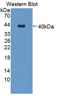 CARP / ANKRD1 Antibody - Western blot of CARP / ANKRD1 antibody.